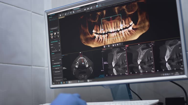 Dental X-Rays and Imaging in New Port Richey East, FL